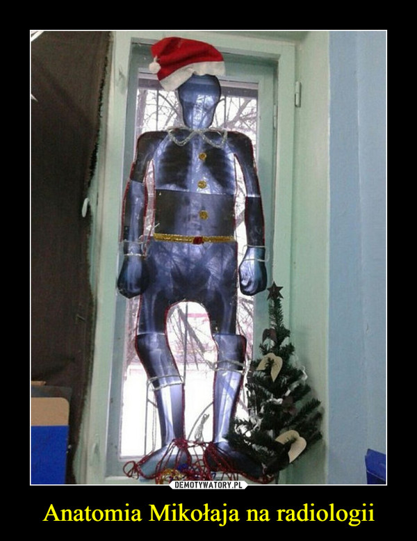 Anatomia Mikołaja na radiologii –  