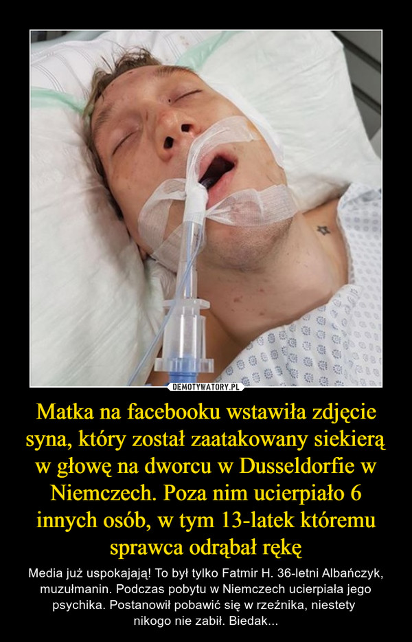 Matka na facebooku wstawiła zdjęcie syna, który został zaatakowany siekierą w głowę na dworcu w Dusseldorfie w Niemczech. Poza nim ucierpiało 6 innych osób, w tym 13-latek któremu sprawca odrąbał rękę – Media już uspokajają! To był tylko Fatmir H. 36-letni Albańczyk, muzułmanin. Podczas pobytu w Niemczech ucierpiała jego psychika. Postanowił pobawić się w rzeźnika, niestety nikogo nie zabił. Biedak... 