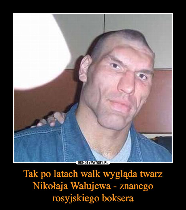 Tak po latach walk wygląda twarz Nikołaja Wałujewa - znanego rosyjskiego boksera –  