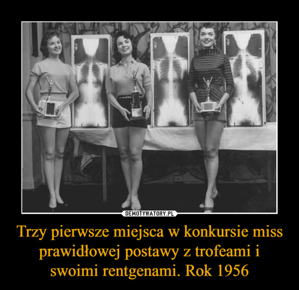 Trzy pierwsze miejsca w konkursie miss prawidłowej postawy z trofeami i swoimi rentgenami. Rok 1956 –  
