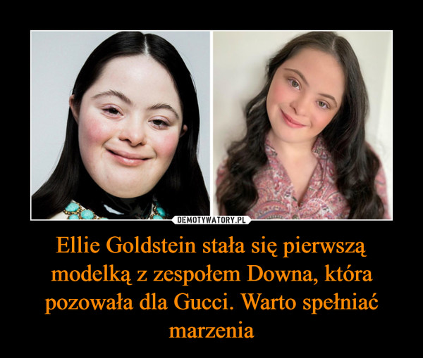 Ellie Goldstein stała się pierwszą modelką z zespołem Downa, która pozowała dla Gucci. Warto spełniać marzenia –  