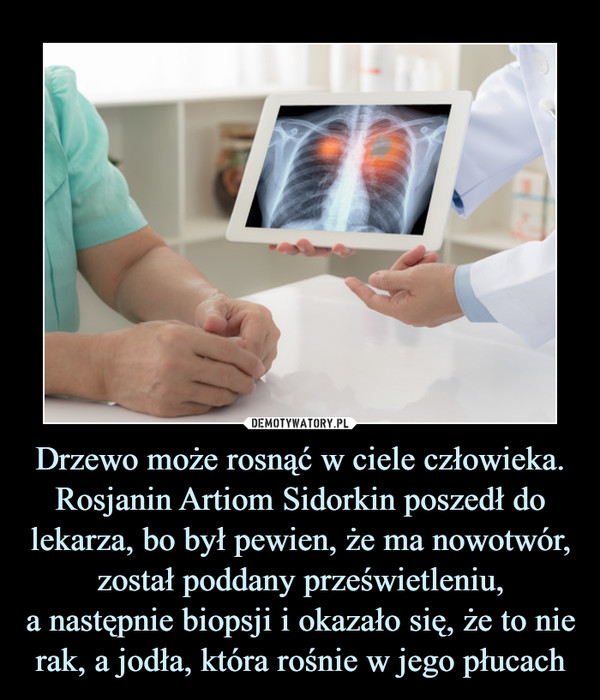 Drzewo może rosnąć w ciele człowieka. Rosjanin Artiom Sidorkin poszedł do lekarza, bo był pewien, że ma nowotwór, został poddany prześwietleniu,a następnie biopsji i okazało się, że to nie rak, a jodła, która rośnie w jego płucach –  