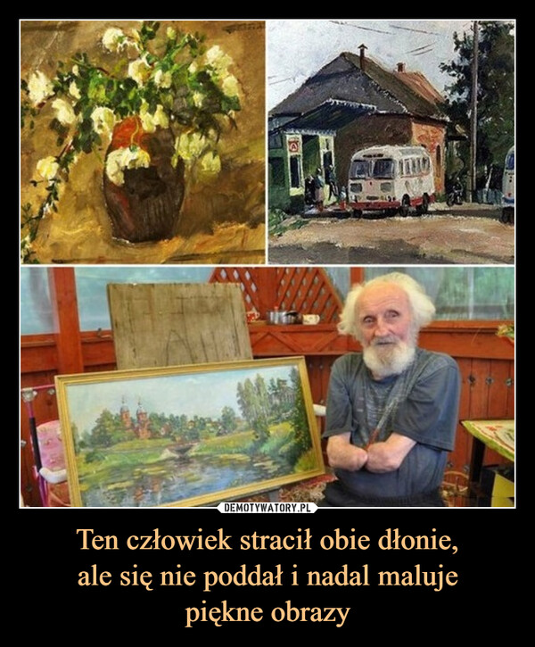 Ten człowiek stracił obie dłonie,ale się nie poddał i nadal malujepiękne obrazy –  שי1